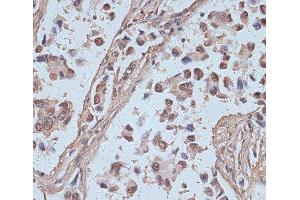 Immunohistochemistry (Paraffin-embedded Sections) (IHC (p)) image for anti-SNW Domain Containing 1 (SNW1) antibody (ABIN7257970)