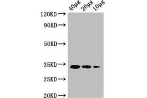Western Blot Positive WB detected in: Rosseta bacteria lysate at 40 μg, 20 μg, 10 μg All lanes: ldcA antibody at 1 μg/mL Secondary Goat polyclonal to rabbit IgG at 1/50000 dilution predicted band size: 34 kDa observed band size: 34 kDa (LDCA (AA 1-304) 抗体 (Biotin))