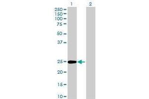 Lane 1: KIAA1109 transfected lysate ( 22. (KIAA1109 293T Cell Transient Overexpression Lysate(Denatured))