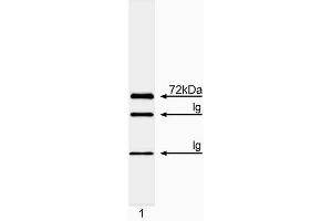 Immunoprecipitation/western blot analysis of Itk. (ITK 抗体  (AA 1-26))