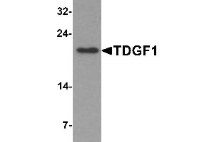 Western Blotting (WB) image for anti-Teratocarcinoma-Derived Growth Factor 1 (TDGF1) (N-Term) antibody (ABIN1077401) (TDGF1 抗体  (N-Term))