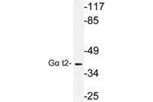 Western blot (WB) analysis of Gα t2 antibody in extracts from COLO cells. (GNAT2 抗体)