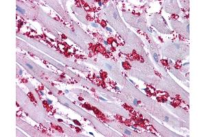 Immunohistochemistry (IHC) image for anti-Potassium Voltage-Gated Channel, Shaker-Related Subfamily, Member 10 (KCNA10) (N-Term) antibody (ABIN501379) (KCNA10 抗体  (N-Term))