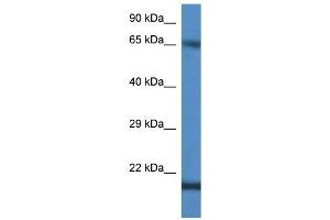 Western Blot showing CTAG1B antibody used at a concentration of 1 ug/ml against Jurkat Cell Lysate (CTAG1B 抗体  (C-Term))
