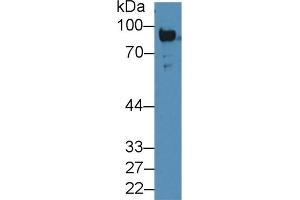 Detection of Plg in Rat Serum using Polyclonal Antibody to Plasminogen (Plg) (PLG 抗体  (AA 191-433))