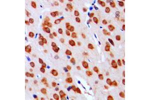 Immunohistochemical analysis of DGK alpha staining in human brain formalin fixed paraffin embedded tissue section. (DGKA 抗体  (Center))
