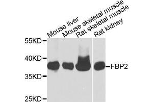 Western blot analysis of extracts of various cells, using FBP2 antibody. (FBP2 抗体)
