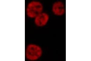 ABIN6268985 staining HeLa cells by IF/ICC. (HNRNPD/AUF1 抗体  (pSer83))
