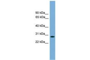 Image no. 1 for anti-Apolipoprotein L Domain Containing 1 (APOLD1) (AA 179-228) antibody (ABIN6746313) (APOLD1 抗体  (AA 179-228))
