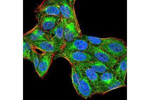 Immunocytochemistry (ICC) image for anti-Protein-tyrosine Phosphatase 1C (PTPN6) (AA 243-541) antibody (ABIN5874772) (SHP1 抗体  (AA 243-541))
