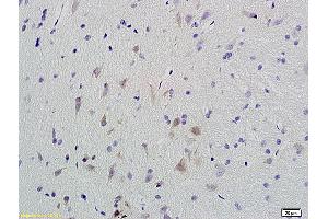 Formalin-fixed and paraffin embedded rat brain labeled with Anti-Phospho-CaMKII (Thr286) Polyclonal Antibody, Unconjugated (ABIN732473) at 1:200 followed by conjugation to the secondary antibody and DAB staining. (CAMK2B 抗体  (pThr287))