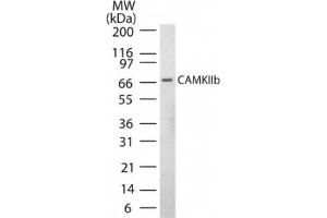 Image no. 1 for anti-Calcium/calmodulin-Dependent Protein Kinase II beta (CAMK2B) (AA 499-513) antibody (ABIN221188) (CAMK2B 抗体  (AA 499-513))