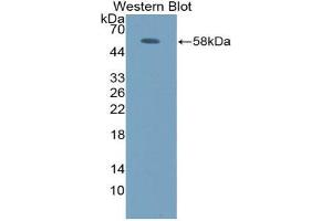 Western blot analysis of the recombinant protein. (FOS 抗体  (AA 6-240))