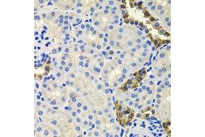 Immunohistochemistry (Paraffin-embedded Sections) (IHC (p)) image for anti-Calbindin 2 (CALB2) (AA 1-271) antibody (ABIN6137849)