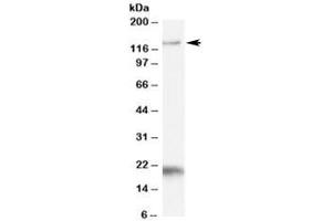 Western blot testing of Daudi cell lysate with HTATSF1 antibody at 1ug/ml. (HTATSF1 抗体)