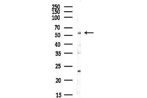 Western blot analysis of lysates from EC304 cells(heat-shock,45 min treatment), using PE2R4 Antibody at 1/1000 dilution.