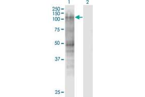 Western Blot analysis of MSH2 expression in transfected 293T cell line by MSH2 monoclonal antibody (M01), clone 2G9. (MSH2 抗体  (AA 835-934))