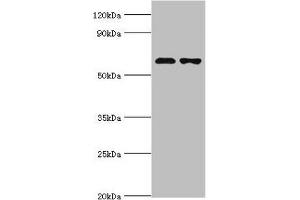 Western blot All lanes: Sterol O-acyltransferase 1 antibody at 2 μg/mL Lane 1: 293T whole cell lysate Lane 2: Jurkat whole cell lysate Secondary Goat polyclonal to rabbit IgG at 1/10000 dilution Predicted band size: 65, 59, 58 kDa Observed band size: 65 kDa (SOAT1 抗体  (AA 1-130))