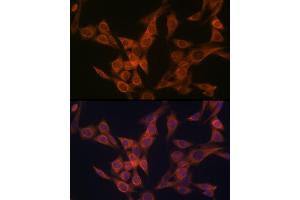 Immunofluorescence analysis of NIH-3T3 cells using ULK3 Rabbit mAb (ABIN7271222) at dilution of 1:100 (40x lens). (ULK3 抗体)