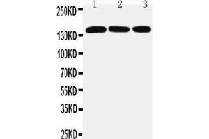 Anti-ATX2 antibody, Western blotting Lane 1: PANC Cell Lysate Lane 2: SMMC Cell Lysate Lane 3: HELA Cell Lysate