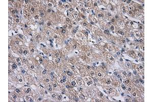 Immunohistochemistry (IHC) image for anti-Aldo-Keto Reductase Family 1, Member A1 (Aldehyde Reductase) (AKR1A1) antibody (ABIN1496541) (AKR1A1 抗体)