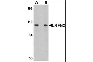 Western blot analysis of LRFN2 in rat brain lysate with this product at (A) 1 and (B) 2 μg/ml. (LRFN2 抗体  (C-Term))