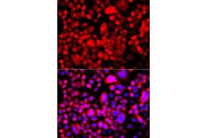 Immunofluorescence analysis of A549 cells using FASN antibody. (Fatty Acid Synthase 抗体  (AA 2212-2511))