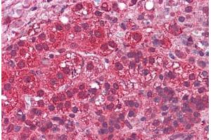 Human Adrenal: Formalin-Fixed, Paraffin-Embedded (FFPE) (LYPD3 抗体  (N-Term))