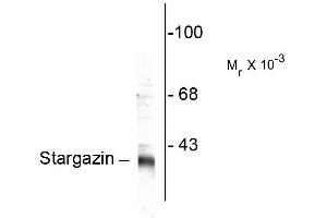 Western blots of rat synaptic membrane (SPM) showing specific immunolabeling of the ~ 36k stargazin protein. (Stargazin 抗体  (C-Term))