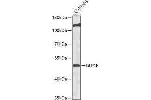 Western blot analysis of extracts of U-87MG cells, using GLP1R antibody (ABIN6131005, ABIN6141137, ABIN6141139 and ABIN6218185) at 1:1000 dilution. (GLP1R 抗体  (AA 22-116))