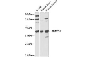 Western blot analysis of extracts of various cell lines, using TIMM50 antibody (ABIN6132725, ABIN6149170, ABIN6149171 and ABIN6225341) at 1:1000 dilution. (TIMM50 抗体  (AA 190-456))