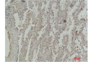 Immunohistochemistry (IHC) image for anti-cAMP Responsive Element Binding Protein 1 (CREB1) antibody (ABIN3181569)