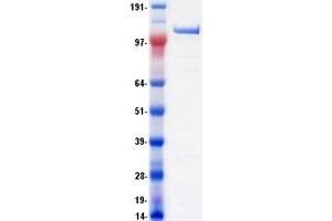 Western Blotting (WB) image for DEAH (Asp-Glu-Ala-His) Box Polypeptide 8 (DHX8) protein (Myc-DYKDDDDK Tag) (ABIN2719467)