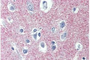 Human Brain, cortex: Formalin-Fixed, Paraffin-Embedded (FFPE) (ADAM8 抗体  (AA 763-824))