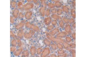 Used in DAB staining on fromalin fixed paraffin- embedded Kidney tissue (OCT4 抗体  (AA 136-360))