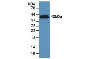 Detection of Recombinant HIF1a, Human using Polyclonal Antibody to Hypoxia Inducible Factor 1 Alpha (HIF1a)