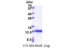 SDS-PAGE (SDS) image for Cysteine-Rich Protein 1 (Intestinal) (CRIP1) (AA 1-77) protein (His tag) (ABIN5853298) (CRIP1 Protein (AA 1-77) (His tag))