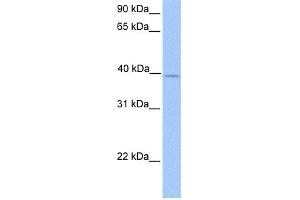 WB Suggested Anti-ZFP92 Antibody Titration:  0. (ZNF92 抗体  (Middle Region))