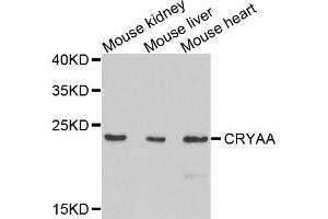 Western blot analysis of extracts of mouse tissues, using CRYAA antibody. (CRYAA 抗体)