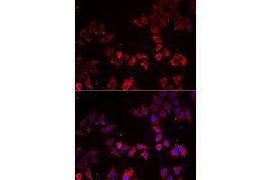 Immunofluorescence analysis of A549 cell using LIMS1 antibody. (LIMS1 抗体)