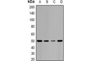 Western blot analysis of Pontin 52 expression in MCF7 (A), HepG2 (B), mouse spleen (C), mouse brain (D) whole cell lysates. (RUVBL1 抗体)