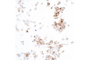 Immunocytochemistry (ICC) image for anti-Platelet Derived Growth Factor Receptor beta (PDGFRB) (AA 33-532) antibody (ABIN7453377) (Recombinant PDGFRB 抗体  (AA 33-532))