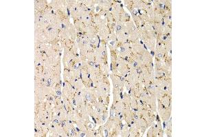 Immunohistochemistry of paraffin-embedded mouse heart using SFRP2 antibody (ABIN5973117) at dilution of 1/200 (40x lens). (SFRP2 抗体)