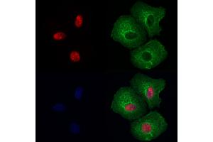 NUCL Antibody staining Hela cells by IF/ICC. (Nucleolin 抗体  (Internal Region))