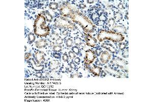 Immunohistochemistry (IHC) image for anti-Zinc Finger (CCCH Type), RNA-Binding Motif and serine/arginine Rich 2 (ZRSR2) (C-Term) antibody (ABIN2778926)