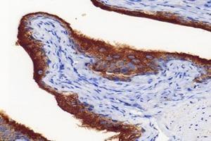 Immunohistochemistry analysis of paraffin-embedded mouse bladder using,Uroplakin Ia (ABIN7076160) at dilution of 1: 4000 (UPK1A 抗体)