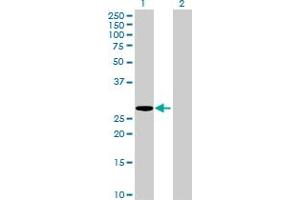 Western Blot analysis of HLA-DMA expression in transfected 293T cell line by HLA-DMA MaxPab polyclonal antibody. (HLA-DMA 抗体  (AA 1-261))