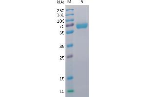 SDS-PAGE (SDS) image for CD48 (CD48) (AA 27-220) protein (mFc-His Tag) (ABIN6961089)