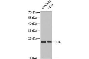 Western blot analysis of extracts of various cell lines using BTC Polyclonal Antibody at dilution of 1:1000. (Betacellulin 抗体)