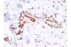 Formalin-fixed, paraffin-embedded human Skin stained with Collagen VII Mouse Monoclonal Antibody (LH7. (COL7A1 抗体)